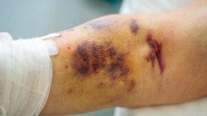 USPS reminds employees to be safe when operating equipment